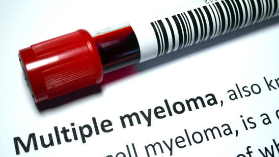 Bone pain from multiple myeloma: Here's how the symptoms can be treated (Photo by Twitter/CHENNashville )